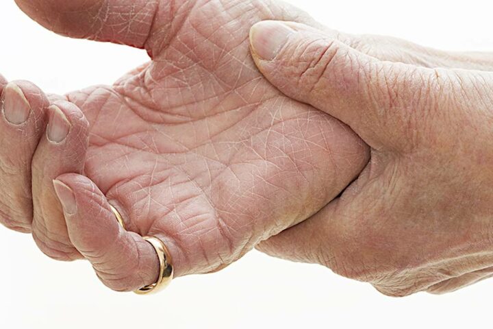 artrite degenerativa cura