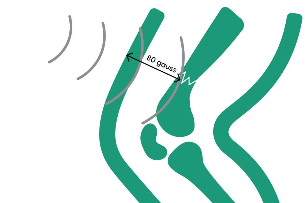 Cómo elegir su dispositivo de magnetoterapia - VEM